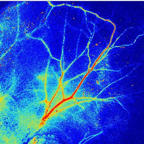 Laser Speckle Contrast Imaging RFLSI Ⅲ FullField Blood Flow Imaging