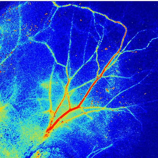 Laser Speckle Contrast Imaging RFLSI Ⅲ FullField Blood Flow Imaging