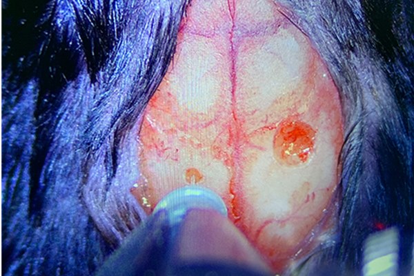 Fiber-Optic-Cannula-Implantation