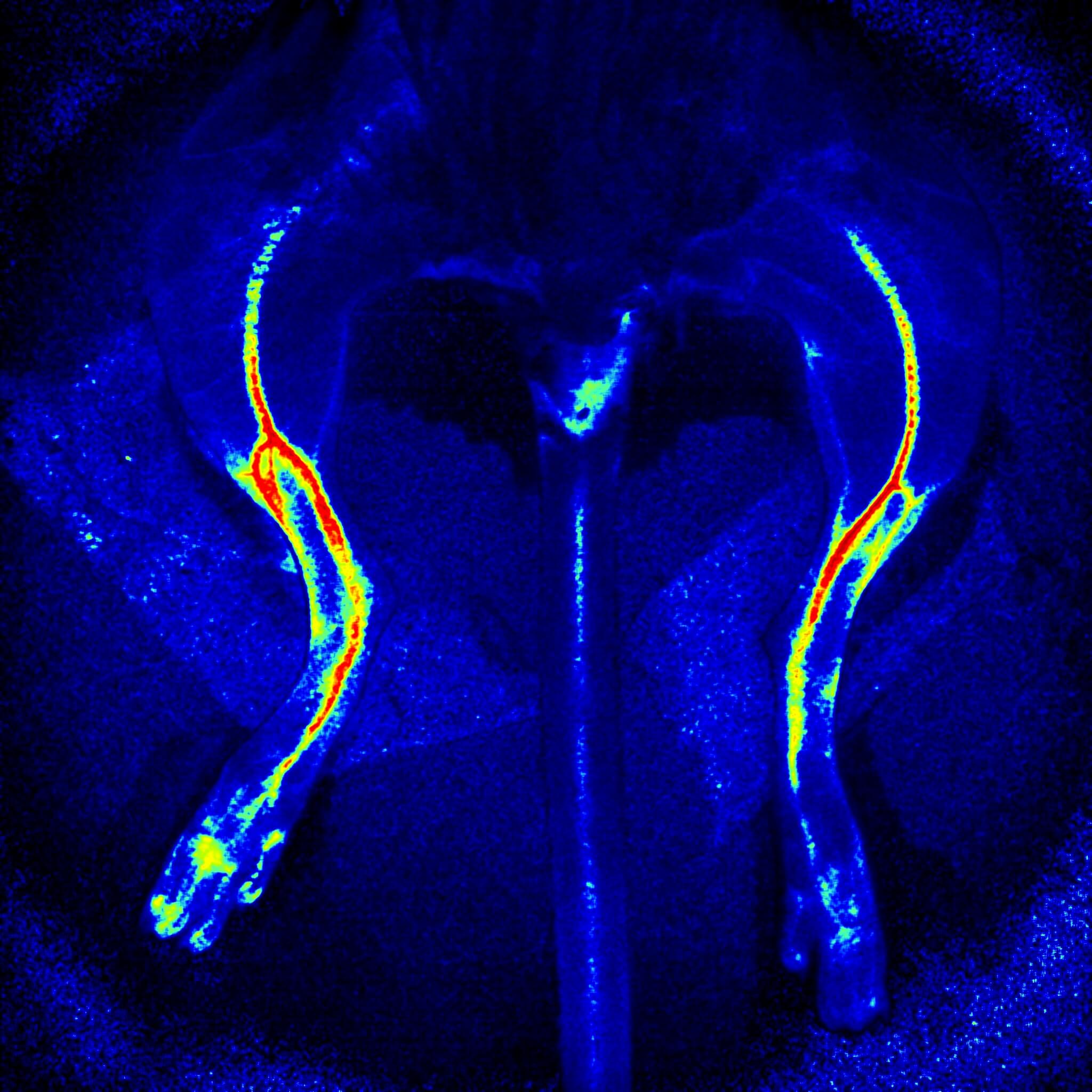 Hind limb ischemia research
