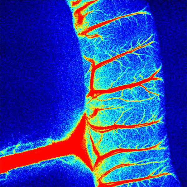 blood flow imaging