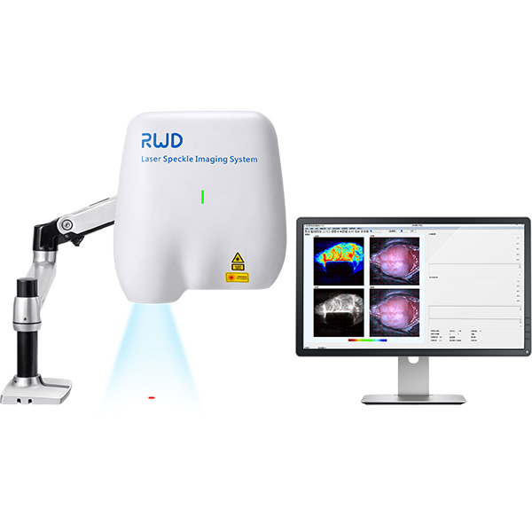 laser speckle blood flow monitoring