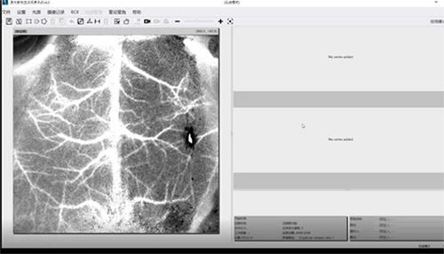 Application of LSCI to Ischemic Stroke Model Research