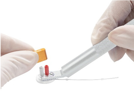 Catheter implanted in vivo ——Implantable vascular access button——Protective cap——Button holder