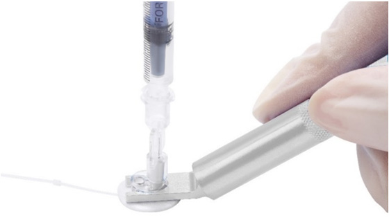 Catheter implanted in vivo——Implantable vascular access button——Syringe adapter——Syringe——Button holder