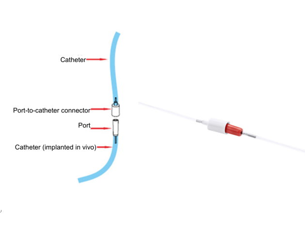 catheter
