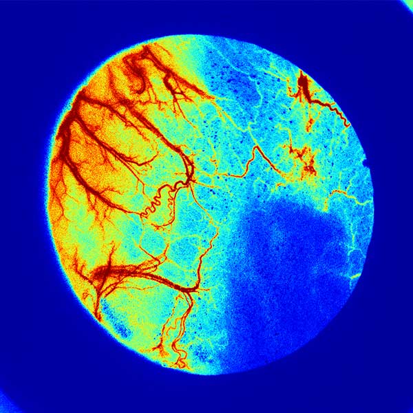 Example image of laser speckle