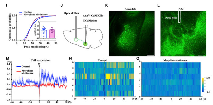 Application of Fiber Photometry in the Study of Neurological Disorders
