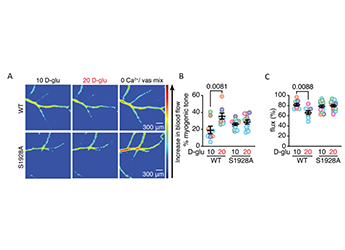 Laser-Speckle-Contrast-Imaging-System