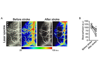 Laser-Speckle-Contrast-Imaging-System