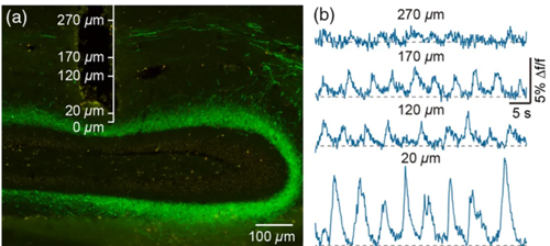 Fiber-Implant-