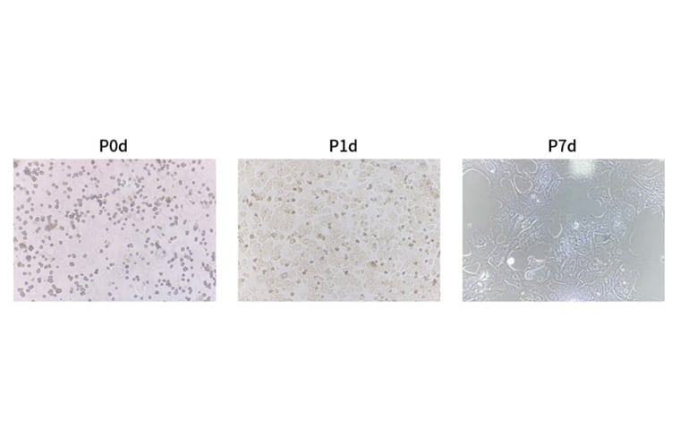 Performing the two-step perfusion method on mice