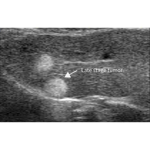 High Frequency Small Animal Ultrasound Imaging System