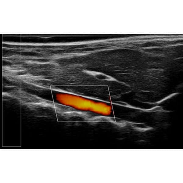 High Frequency Small Animal Ultrasound Imaging System