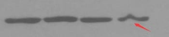 Western Blot experiment results