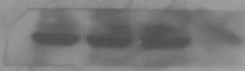 Western Blot experiment results