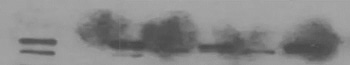 Western Blot experiment results