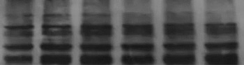 Western Blot experiment results