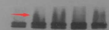 Western Blot experiment results